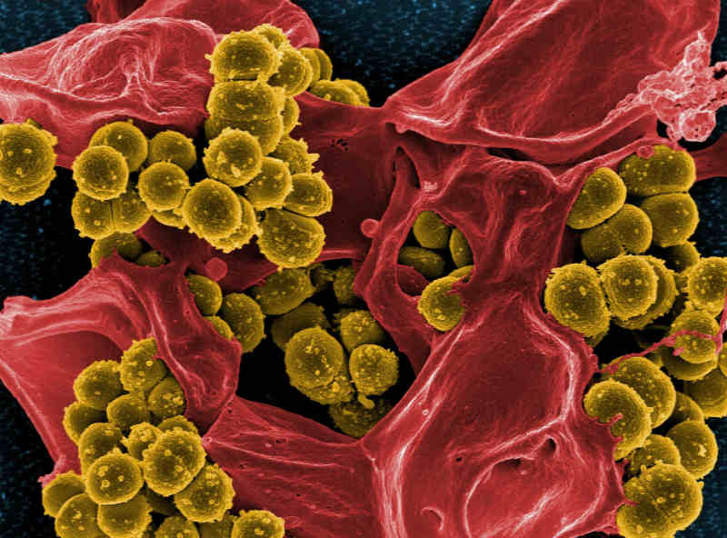 Bacteria Colonize Body Tissue