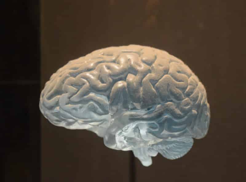 Brain Model
