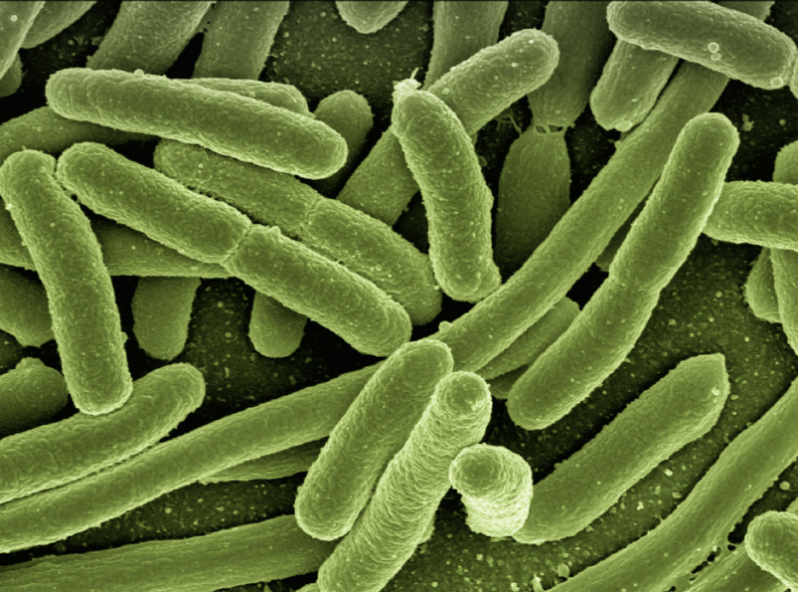 Legionnaire's disease bacteria