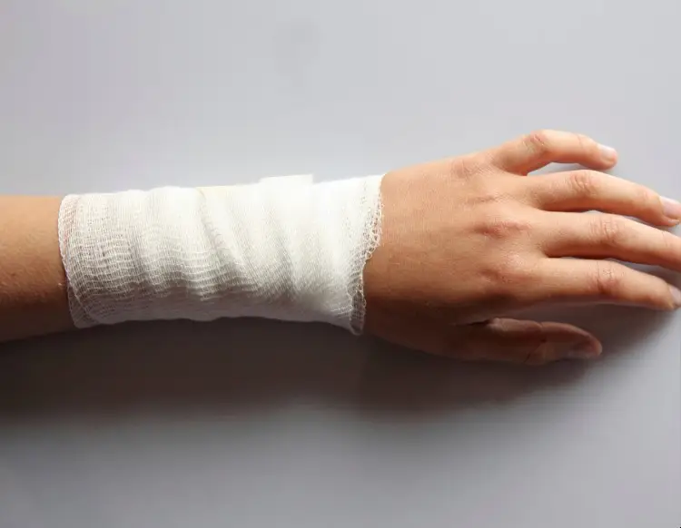 Young Childs Hand Wrapped In Gauze After Home Burn Injury